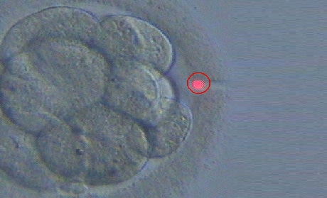 Laser-Assisted-Embryo-Hatching.jpg